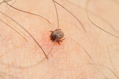 Ixodes ricinus