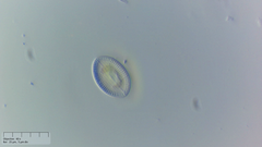 Cocconeis