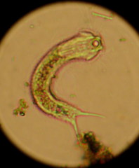 Chaetonotus