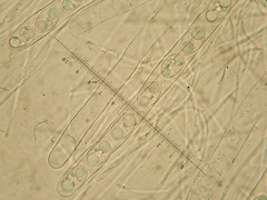 Tarzetta cupularis
