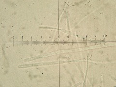 Tarzetta cupularis