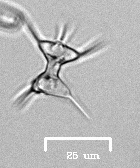 Staurodesmus cuspidatus