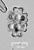 Euastrum gemmatum