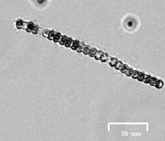 Anabaena