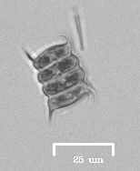 Scenedesmaceae