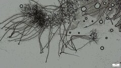 Ceratocladium