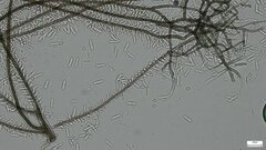 Ceratocladium
