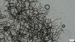 Ceratocladium