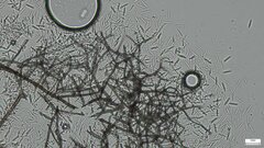Ceratocladium