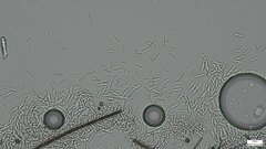 Ceratocladium