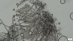 Ceratocladium