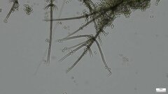 Chloridium gonytrichii