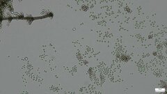 Chloridium gonytrichii