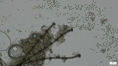 Chloridium gonytrichii