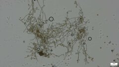 Botryobasidium