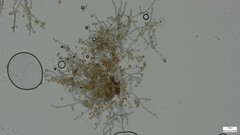 Botryobasidium
