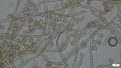 Botryobasidium