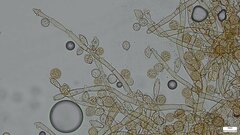 Botryobasidium
