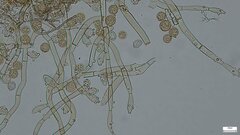 Botryobasidium