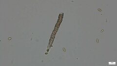 Agaricomycetes