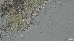 Phlebia