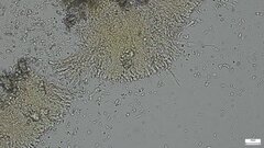 Phlebia