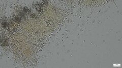 Phlebia