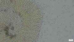 Phlebia