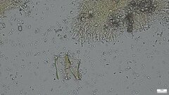 Phlebia