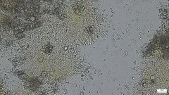 Phlebia