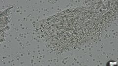 Fomitopsidaceae