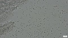 Fomitopsidaceae