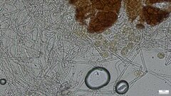 Erysiphe diffusa
