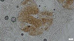 Erysiphe diffusa