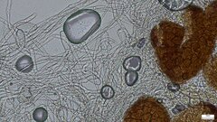 Erysiphe diffusa