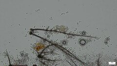 Selenosporella