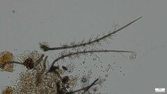 Selenosporella