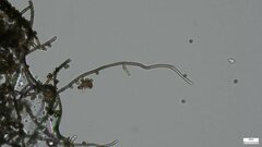 Trichaleurina tenuispora