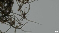 Trichaleurina tenuispora