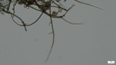 Trichaleurina tenuispora
