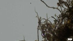 Trichaleurina tenuispora