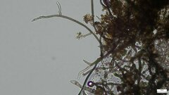 Trichaleurina tenuispora
