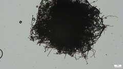 Trichaleurina tenuispora