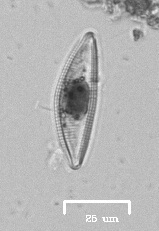 Encyonema