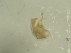 Oncopsis appendiculata