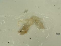 Oncopsis appendiculata