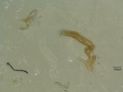 Oncopsis flavicollis