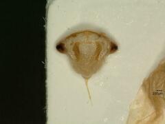 Oncopsis flavicollis