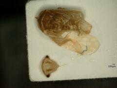 Oncopsis flavicollis