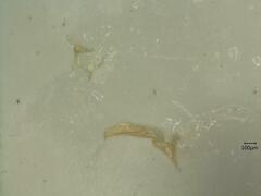 Oncopsis flavicollis